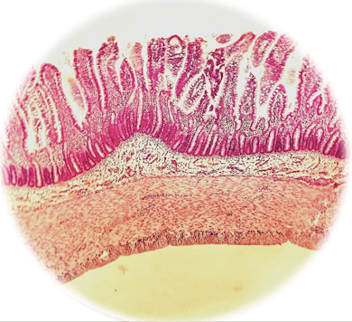 小肠横切显微镜图图片