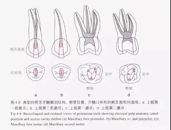 各个牙的开髓法图片图片