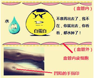 孕34周脚肿了怎么办