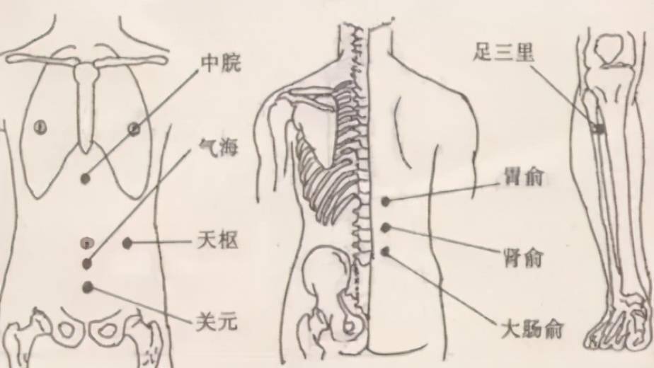 艾灸疗法:自灸足三里,内关,合谷,气海,关元,三阴交等穴.