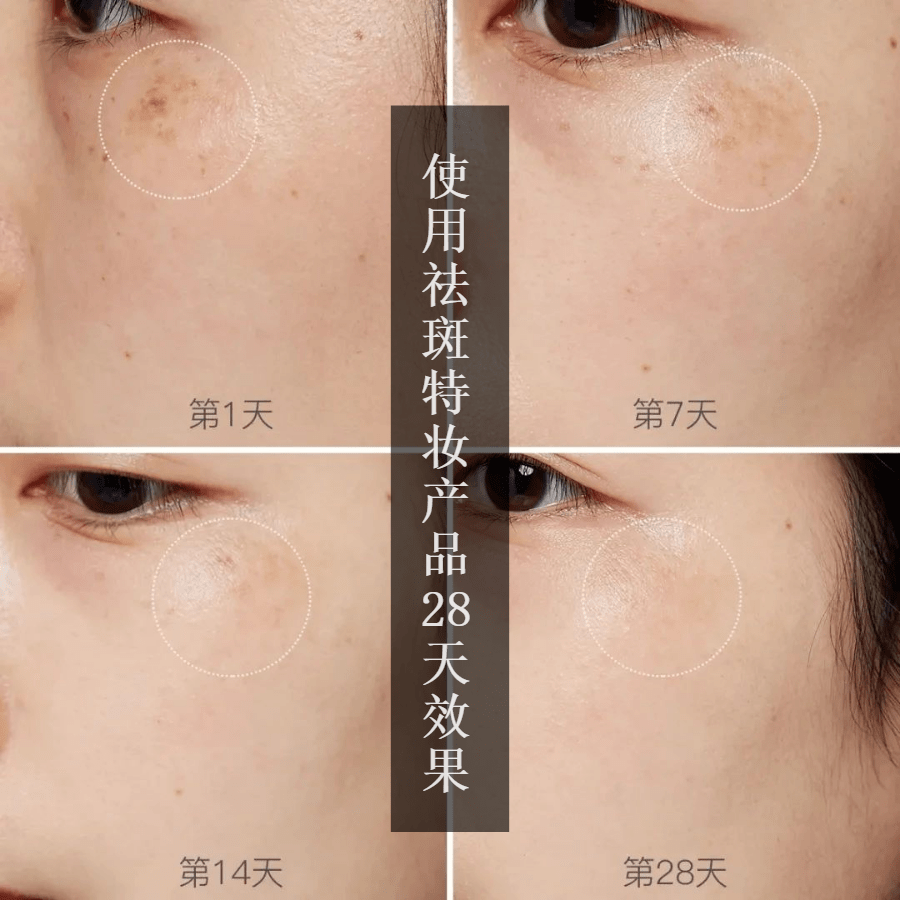 激光祛斑是网红骗局皮肤科医生愤怒回应提醒多次没人听