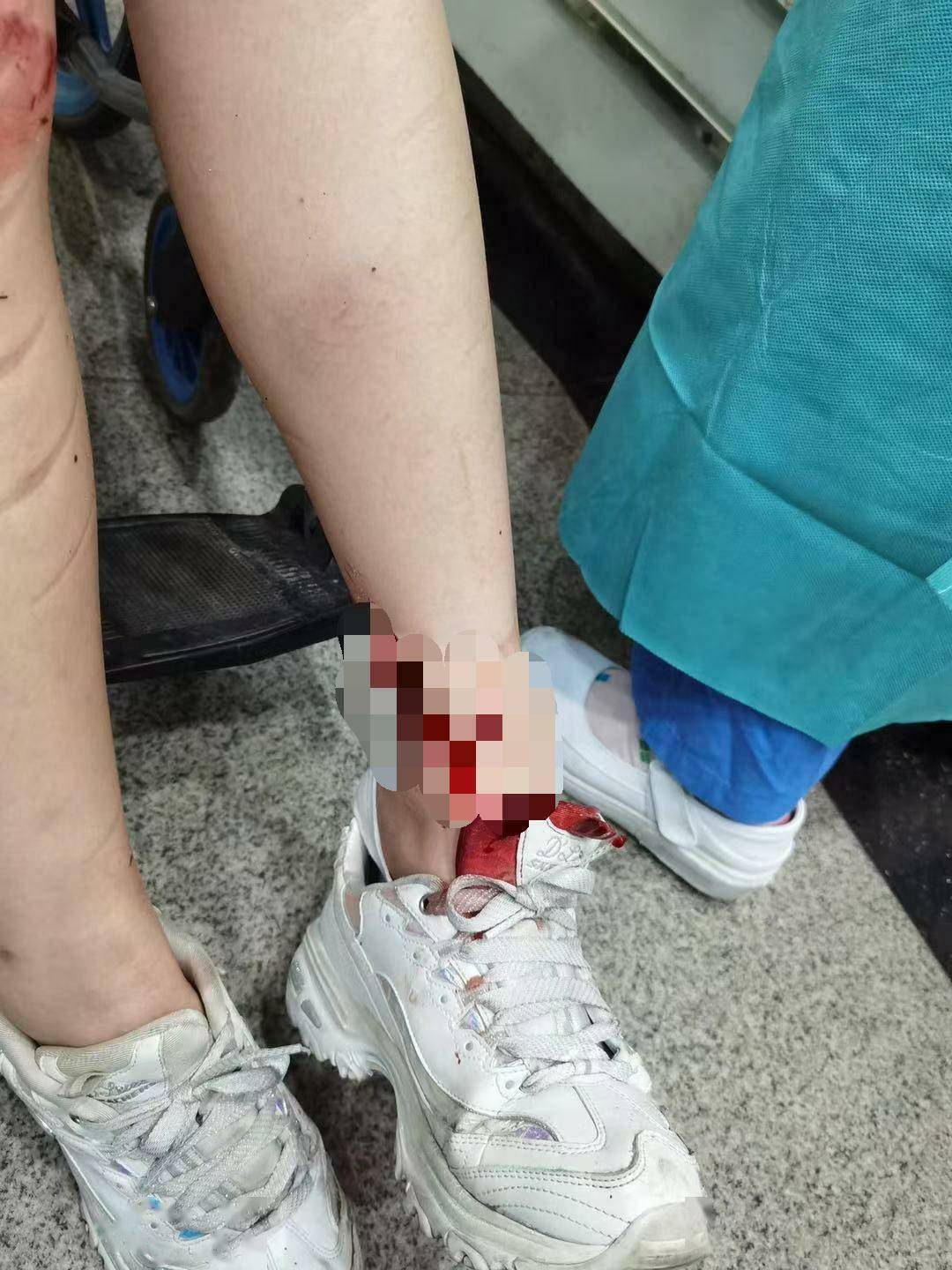 路遇车祸险情 医生下班途中顺手又救了一个小女孩 古瑞平