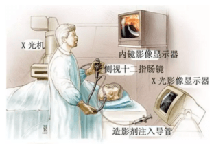 肝功能异常怎么解决 dfadbe53227643fe9d470c252e2a2ce2.png