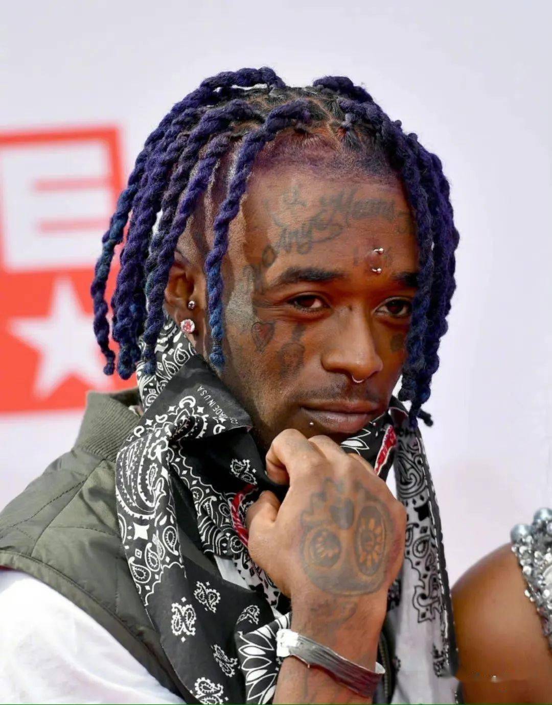 liluzivert粉钻到期额头伤口感染摘掉了2400w美刀的钻石