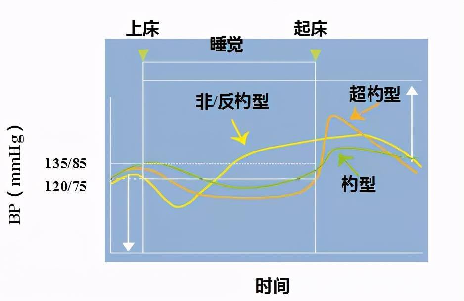 降压要按血压昼夜节律变化选用药时间