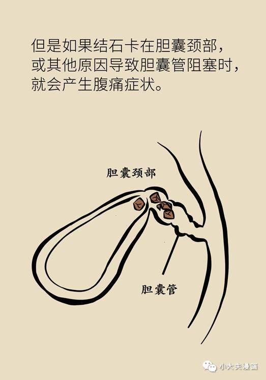 胆汁|不是谣言，长期不吃早饭，真有可能得这种病