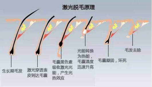 赠品|一到夏天，身上的毛毛就开始疯狂外露……