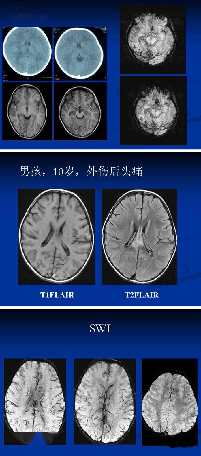 可同时获得幅度图像(magnitude image)和相位图像(phase image)