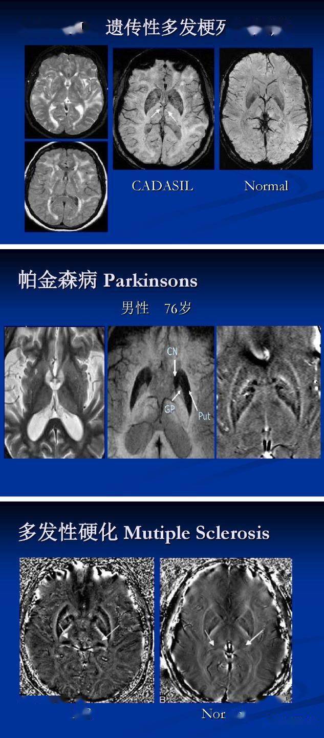可同时获得幅度图像(magnitude image)和相位图像(phase image)