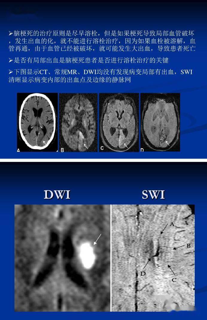 可同时获得幅度图像(magnitude image)和相位图像(phase image)