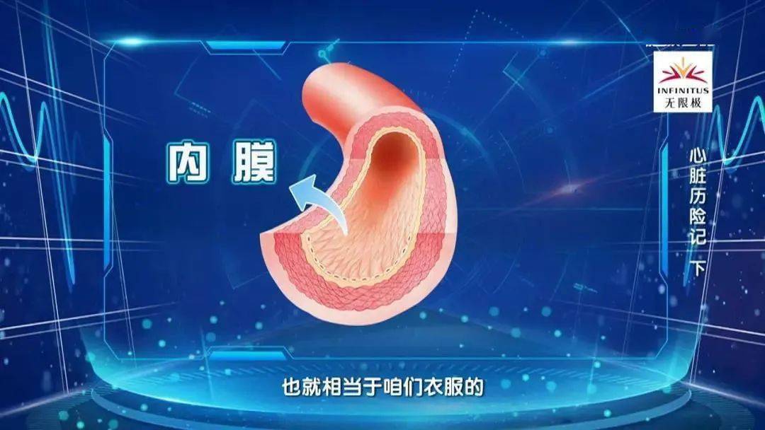 3块钱一斤的血管保护剂常吃恢复血管内皮血液快速通畅