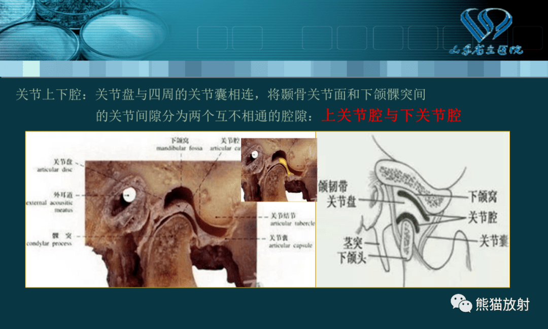 专题丨颞颌关节的MRI检查_诊断