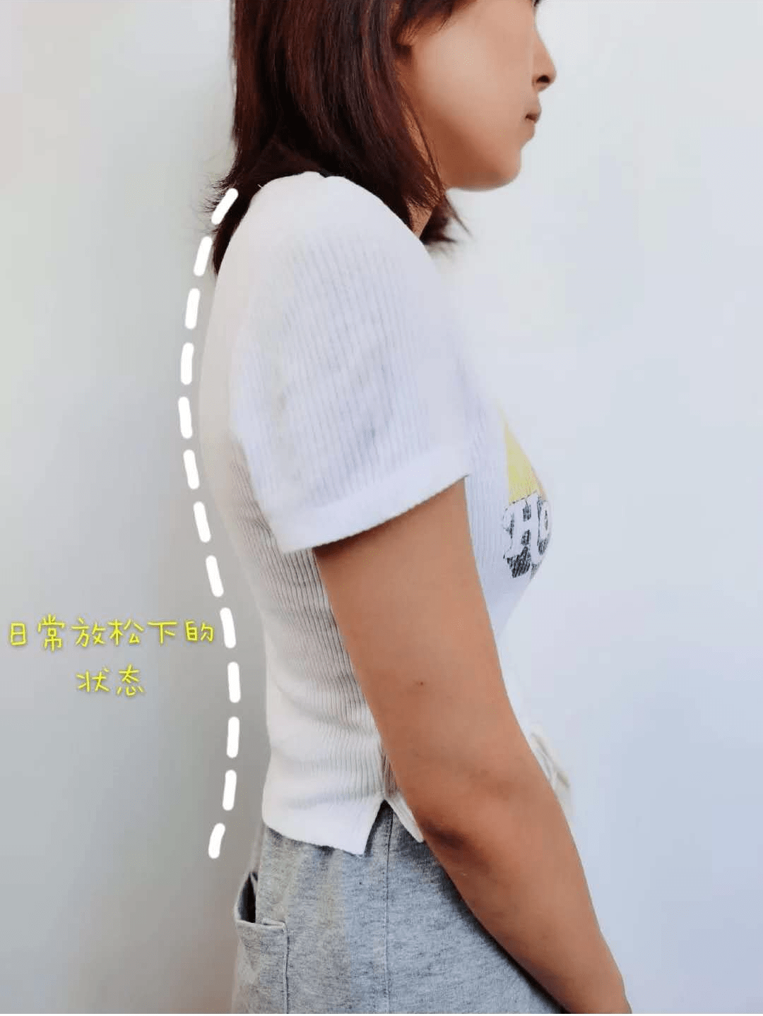 驼背真的好丑好猥琐每天这样做养成直角肩美人背
