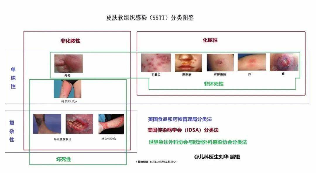 皮肤及软组织感染诊治大全(毛囊炎、疖, 痈、蜂窝织炎、丹毒等)_治疗