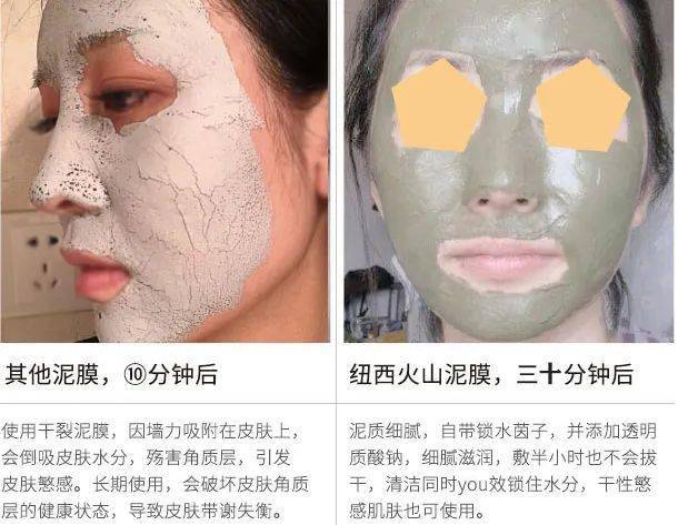 油脂|新西兰百年历史“污垢吸铁石”，15分钟告别黑头、粉刺、闭口