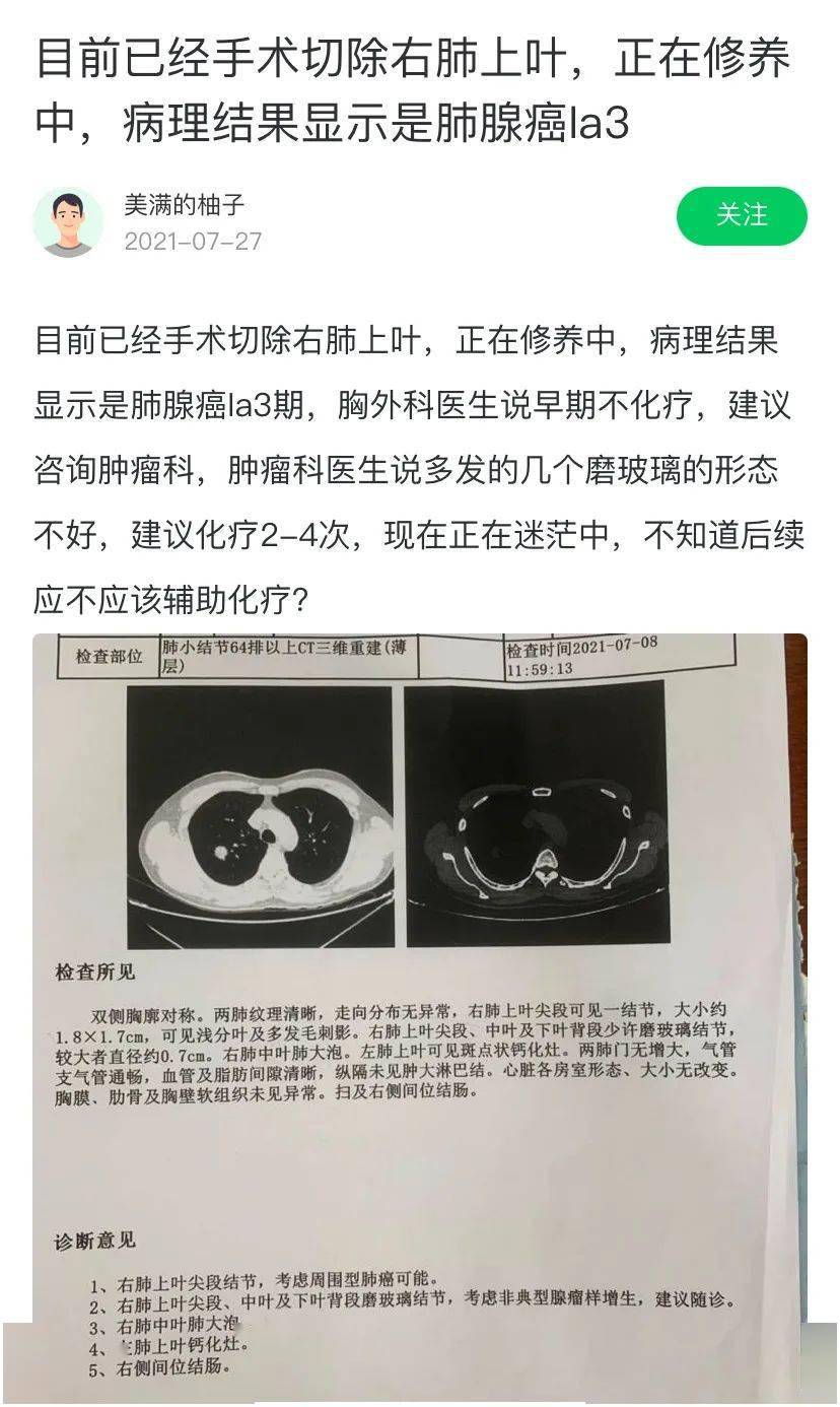 覓健互助 | 手術後病理顯示是肺腺癌Ⅰa3期,後續應不應該輔助化療?