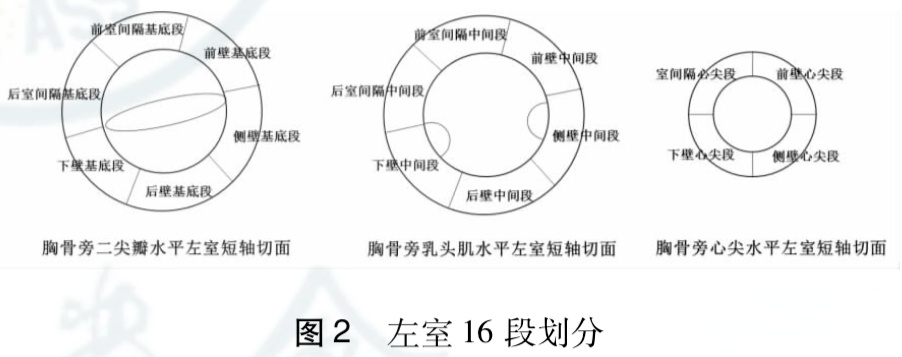 左室壁17节段划分图片