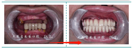 缺失|八月的3项福利补贴，大连市民可报名领取，截止本月底！