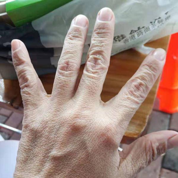 医护|他们累瘫的样子，让人心疼