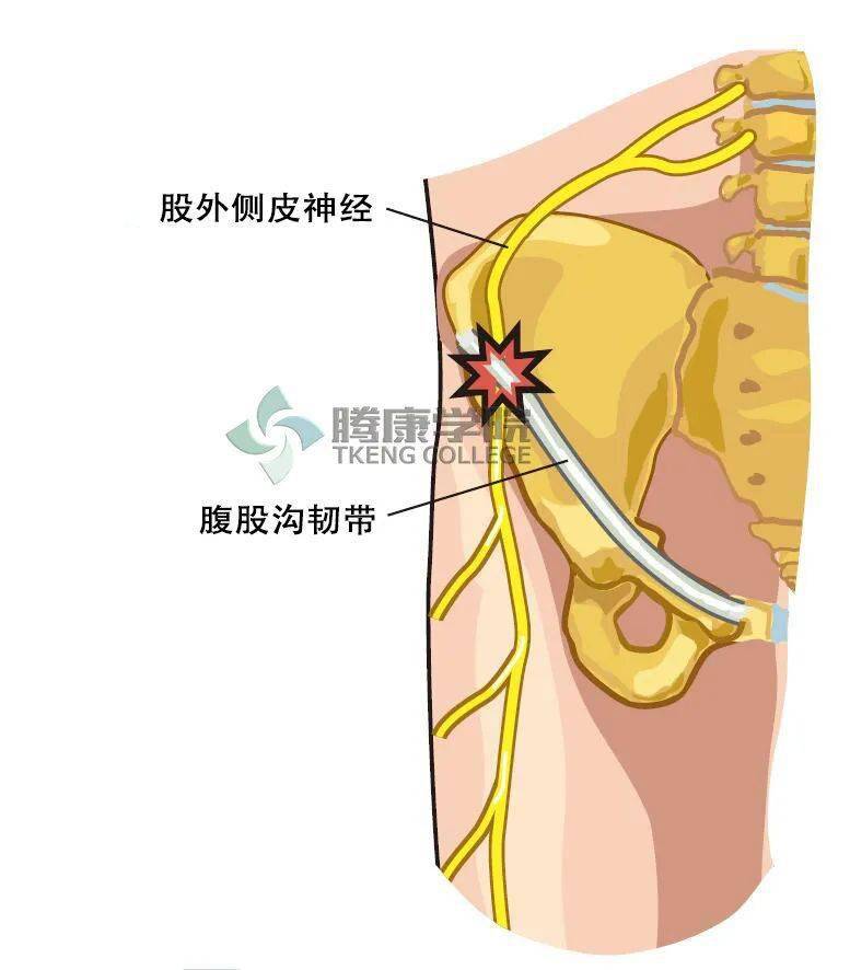 大腿骨痛是什么原因图片