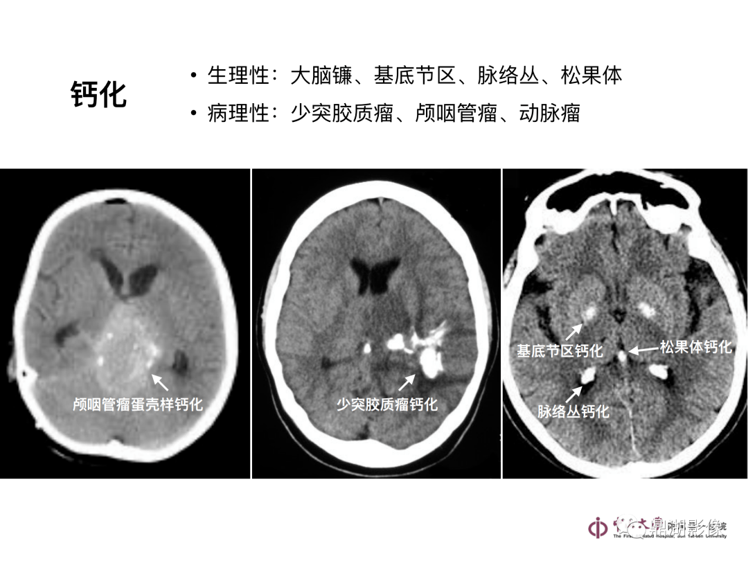 急診頭顱ct-