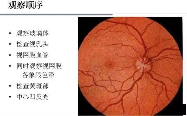 眼底镜检查及眼底病变的记录方法