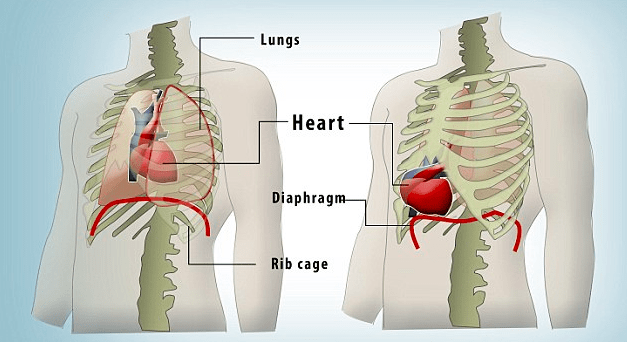 壁,胸骨,膈肌的一系列缺损,坎特雷尔五联症的一个重要表现是心脏异位