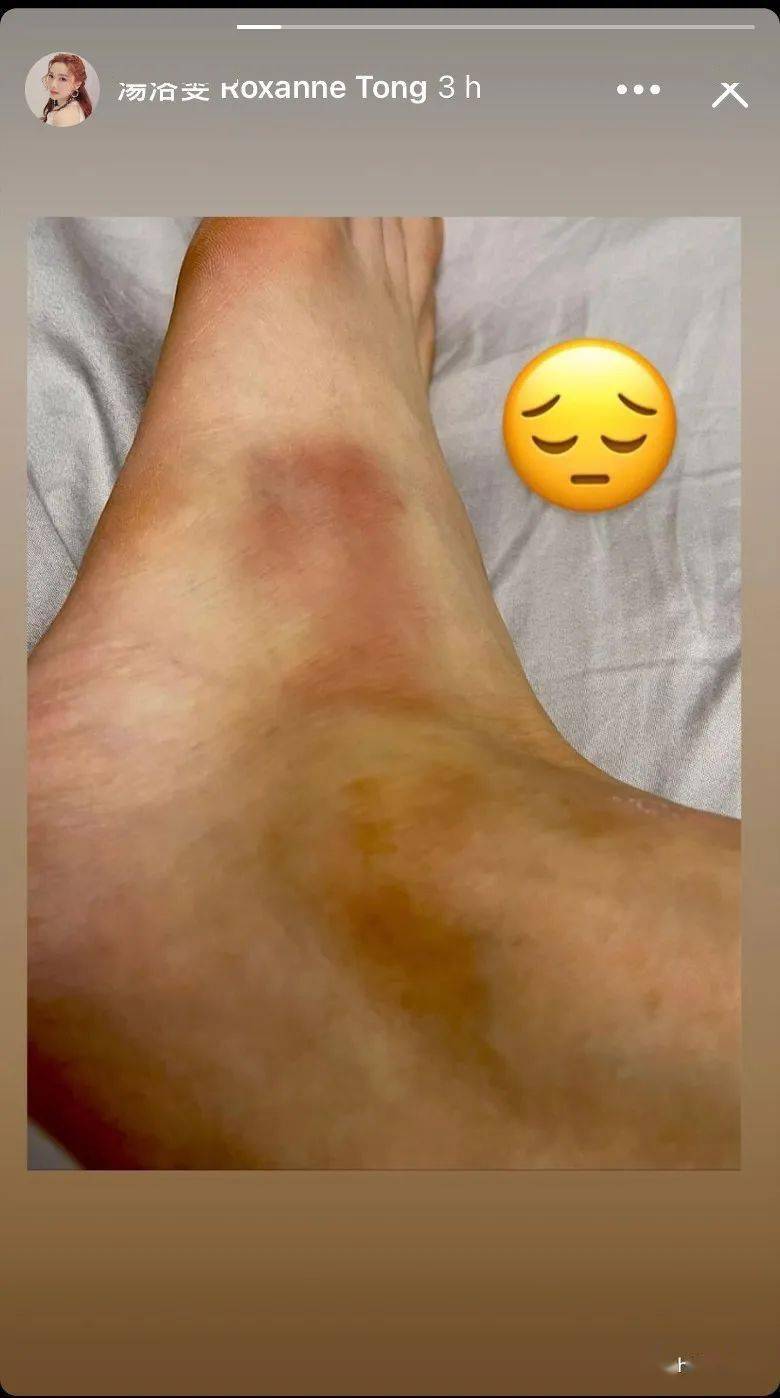 汤洛雯碌落云石楼梯照开工:我系惯性拗柴