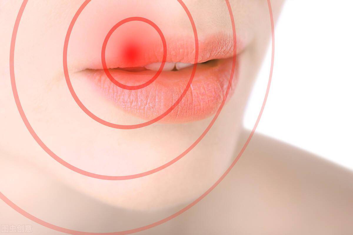 疱疹怎么形成的 2e5b8bcc65e24c6bb1da86402cfcfa83.jpeg