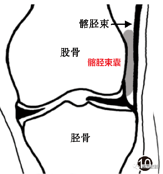 滑膜囊解剖图片