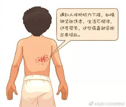 蛇盘|得了带状疱疹有什么临床表现？