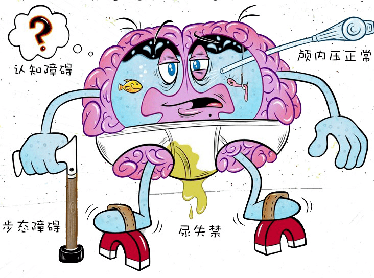 记忆力变差尿失禁这不是老年痴呆是真的脑子进水了