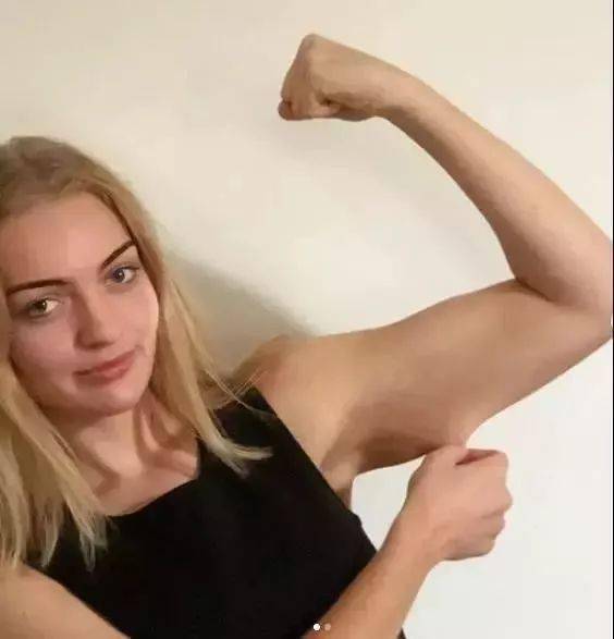 逆转|从254斤到126斤，她教会我们逆转人生