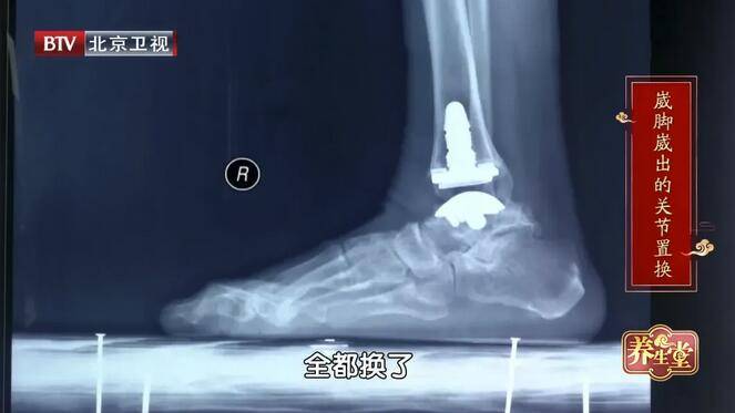 足部|隐藏在脚上的危险信号！