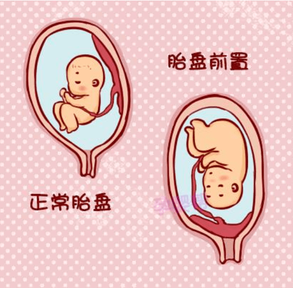 153b28dfc1fd427a8c11431b22687747.png