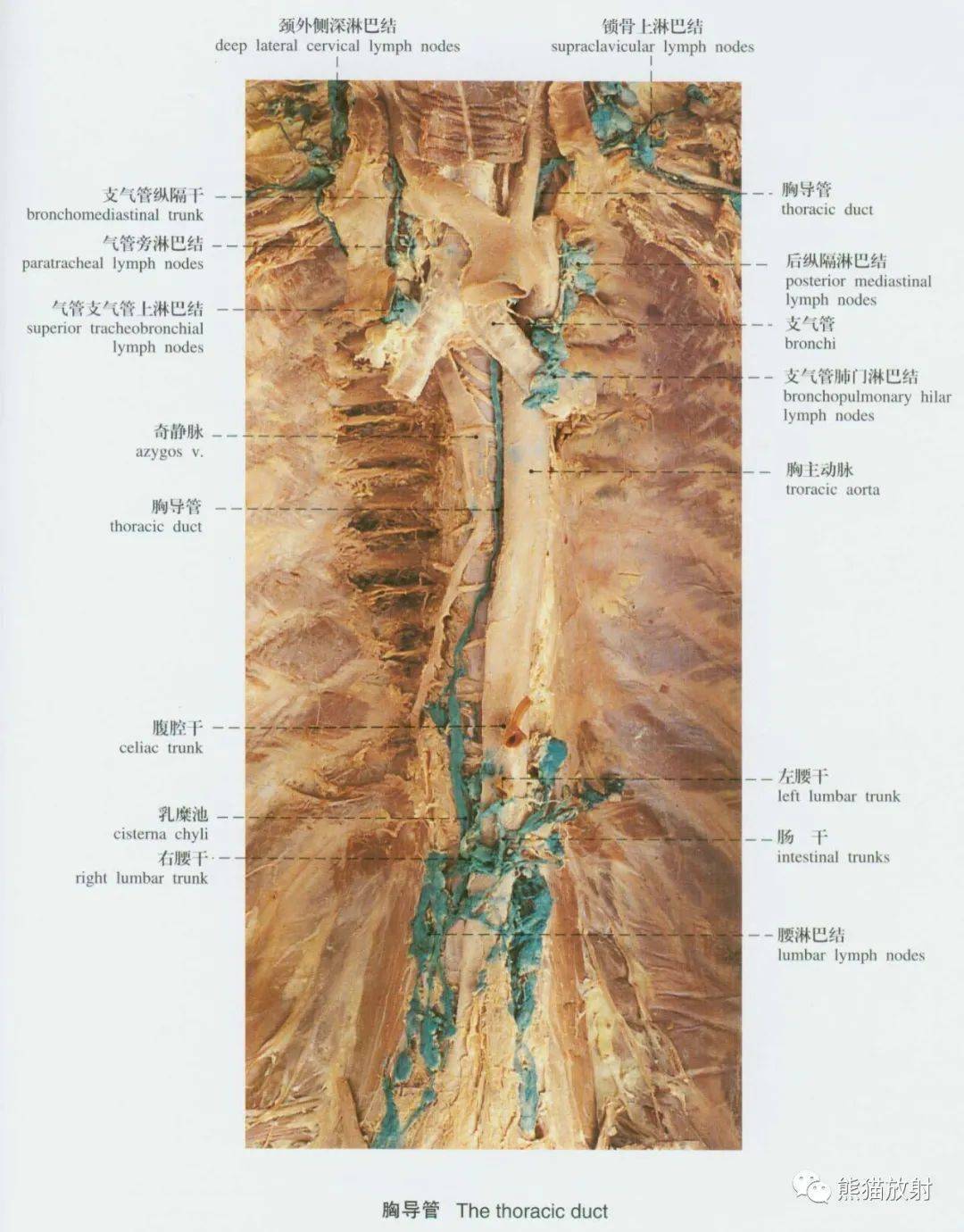 系统解剖标本图谱丨静脉血管系统淋巴系统