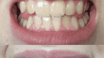 1a23a470b5d4475f9acdf4c328cd443c.gif