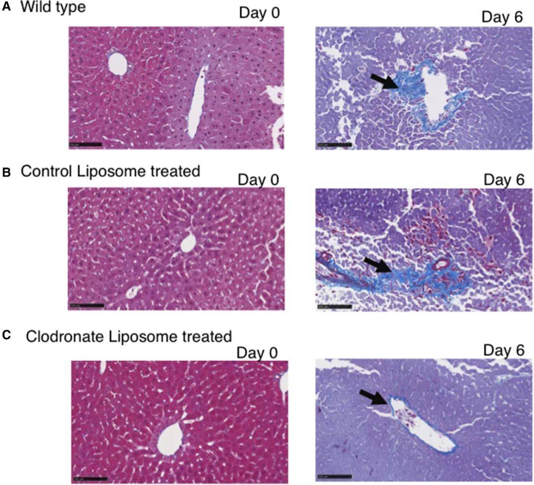 实验室吉林大学第一医院牛俊奇课题组揭秘肝脏kupffer细胞转分化