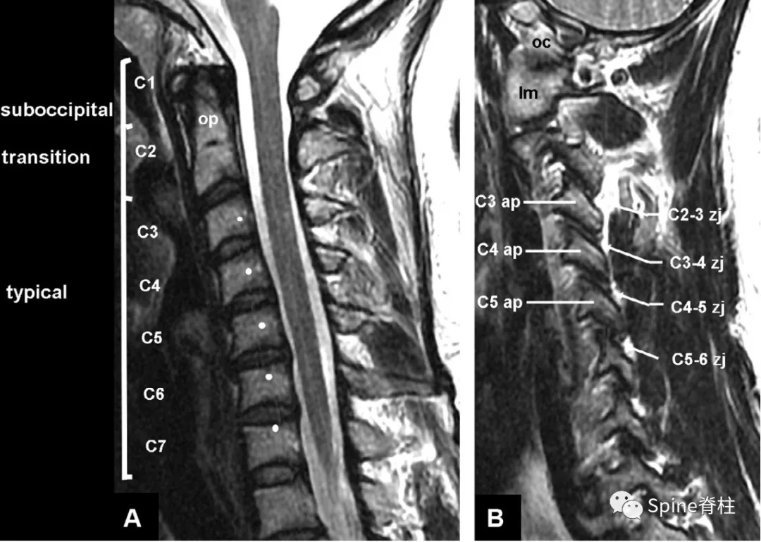 涨见识了!都叫椎间盘,原来颈与腰椎间盘是不同的