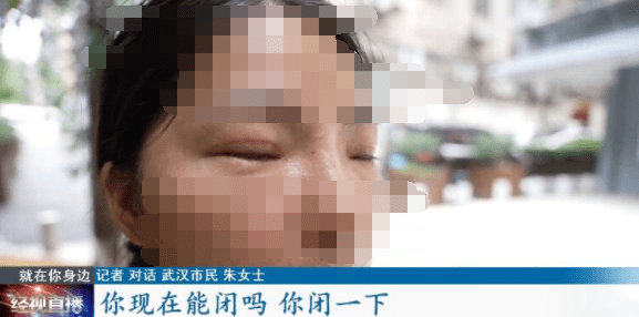 症状|说好的整成舒淇同款鼻,结果连微笑都成问题!更麻烦的是……