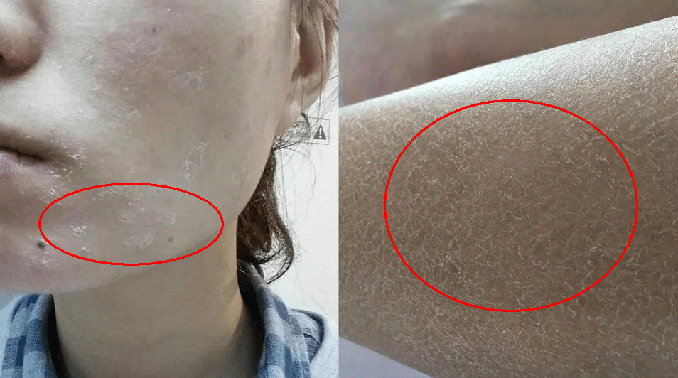 皮肤|观方好物 | 华山医院研制的这罐身体乳，我能囤一辈子