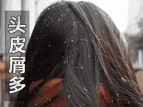 洗头|5天不洗头也能清爽到家?87岁康王创始人再出山,专治头痒头油脱发!