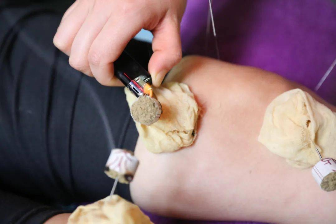 海慈医疗集团打造中医适宜技术中心中医药服务全程守护健康