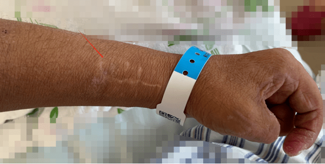 进行|【医患一家】精益求精,迎难而上,肾内科为血液透析患者重建“生命线”