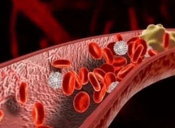 内皮|血管堵死离不开这8个原因！现在改还来得及！