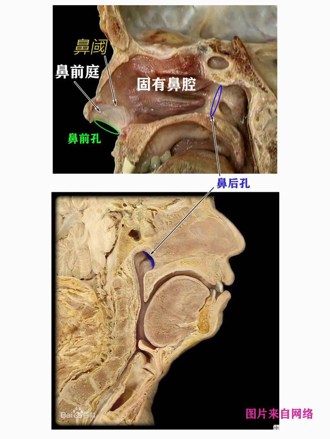 (5)鼻竇開口於鼻腔,經鼻氣插易致鼻竇炎.