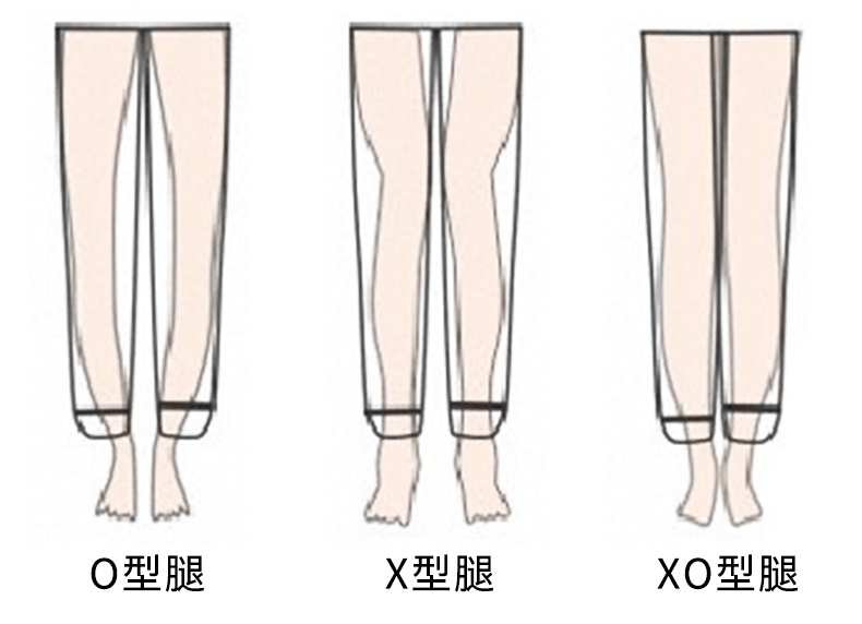 不管是o型腿,x型腿,xo型腿,都能无声无息地帮你遮住.
