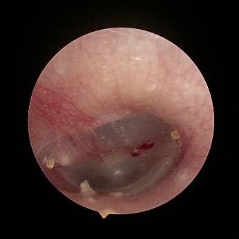 蟑螂|一觉醒来耳朵剧痛，原因竟是爬进这种昆虫