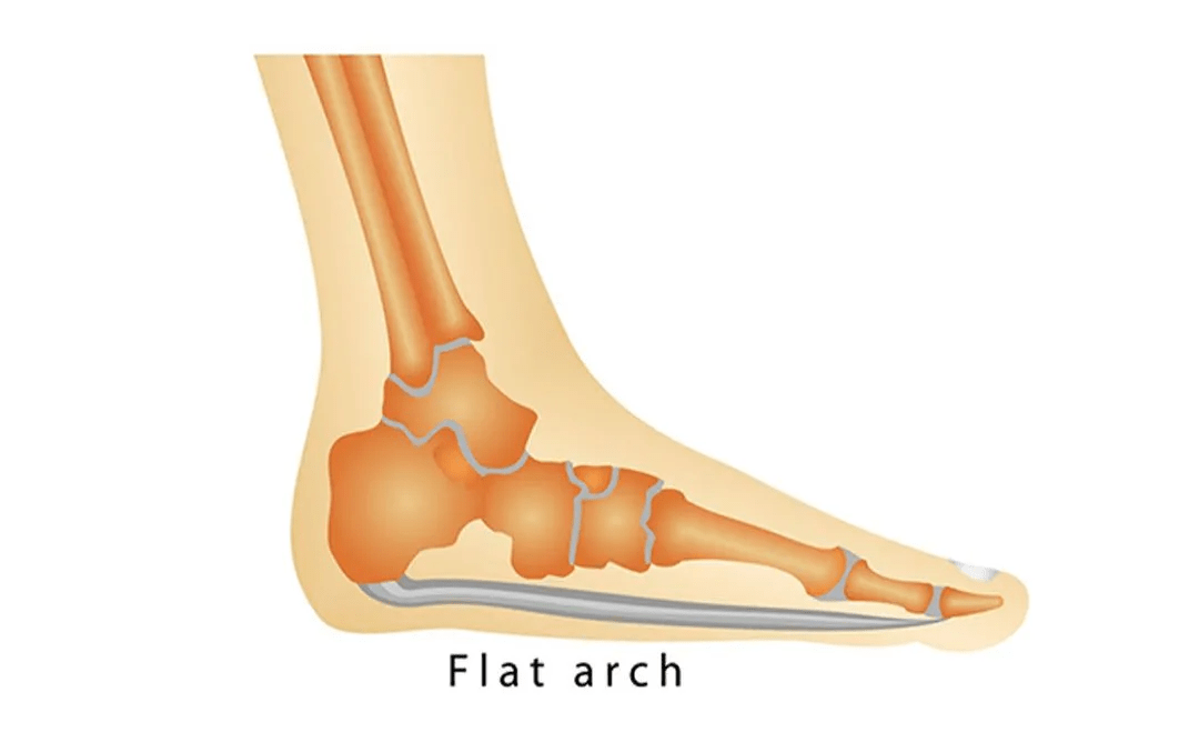 怎么才能瘦脚趾 5c7b79d315814c2aae8f7aea0089ae0c.png