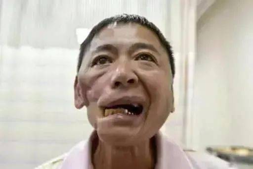 广告|吃了半年，左脸彻底溃烂：这款热门零食，正在危害6000万人的身体......
